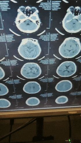 高顏值極品美鮑福利姬【Y-cancan】７Ｐ大亂交